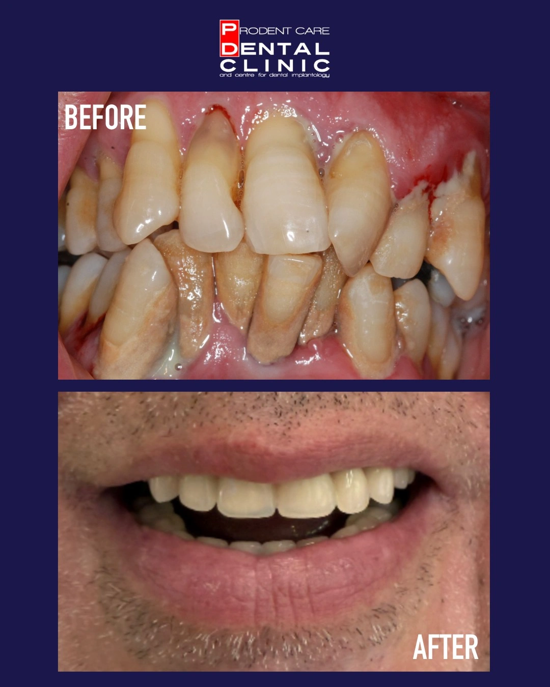 Another Happy Smile at ProDent Care Dental Clinic